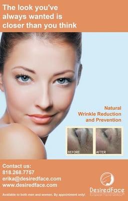 Natural Wrinkle Reduction & Prevention!