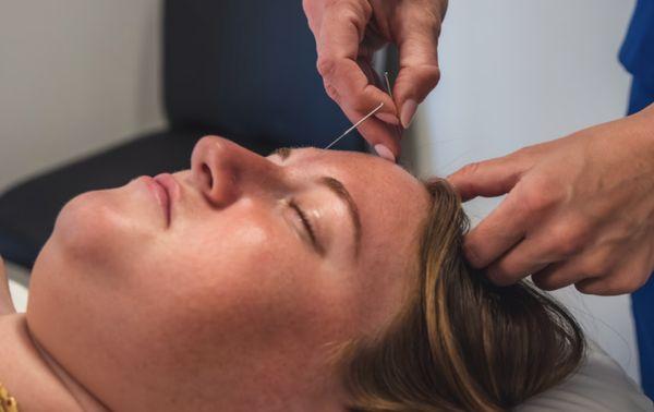 Acupuncture Treatments 
Call Today to Schedule (516) 783-1454