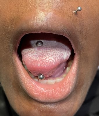 Tongue piercing