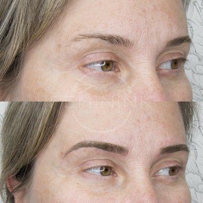 Microblading