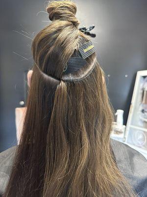 Invisible Bead Extensions exposed from the top and bottom of application