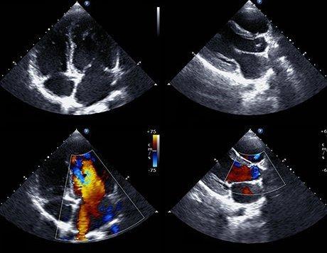 In-Office Echocardiograms