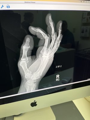 X ray