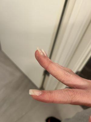 Side of nail