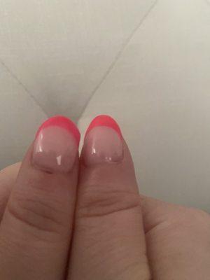 Left nail is misshapen and there is a cut below the nail