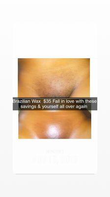 Brazilian wax deals