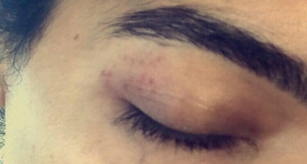 A shorter brow and my eyelid all cut up