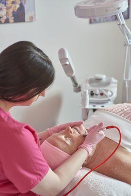 Microdermabrasion gently exfoliates the surface of your skin. Removing this gives your skin a younger appearance.