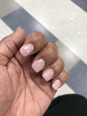 Horrible nails 3 days later