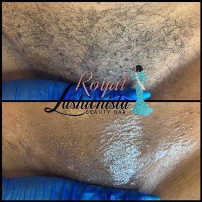 Brazilian wax