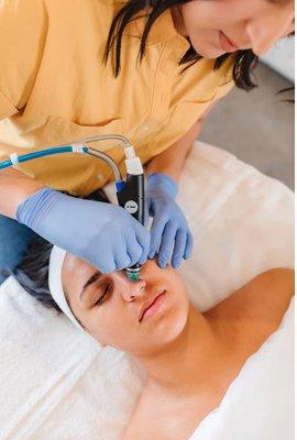 Hydrafacial Treatment