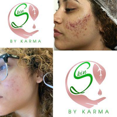 Skin by Karma