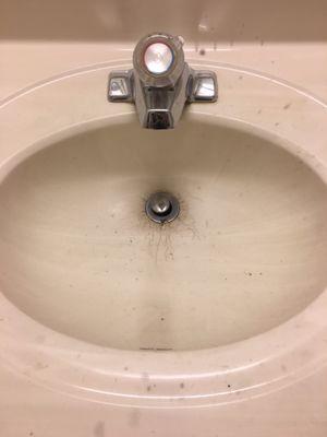 Filthy stains on sink.