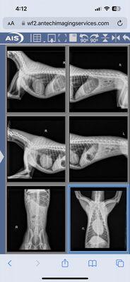 X-rays performed from injury to neck during class