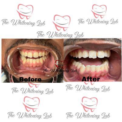 The 20min Whitening Lab