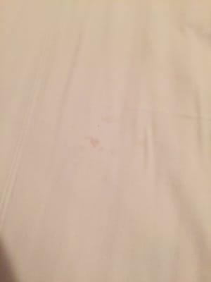 Stains on sheets