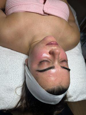 Dermaplaning facial