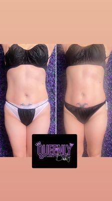 Queenly Body services include Wood Therapy sessions that contour the shape, hips and waistline.