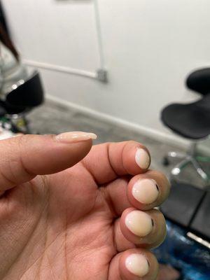 THUMB GEL APPLICATION