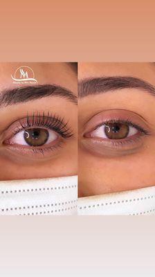 Eyelash lift