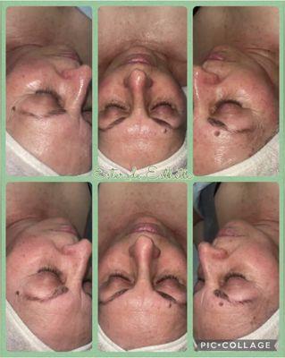 European facial