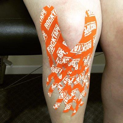 Post knee surgery tape job to reduce swelling.