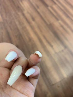 uneven nail