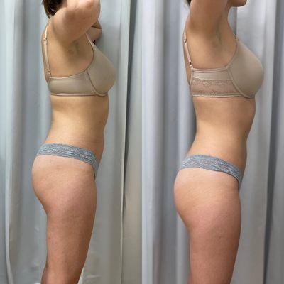 5 Sessions of Bodi-Current Treatments