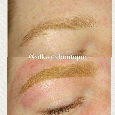 Brow Rehab