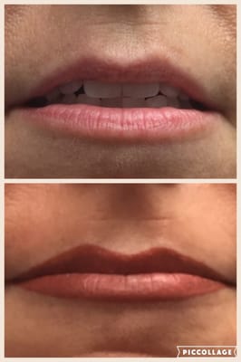 Before and after picture of lips.