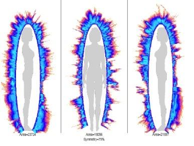 GDV image depiction of the body's area symmetry. A view of the body's ability to handle physical & emotional stress.