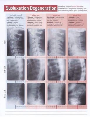 Do you know the condition of your spine? Let us educate and help you!