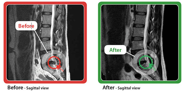 Valley Spinal Decompression Center