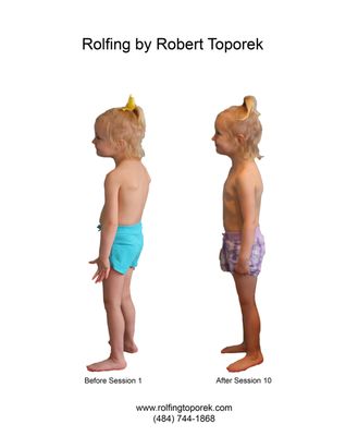 Rolfing By Robert Toporek