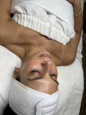 Dermaplane facial