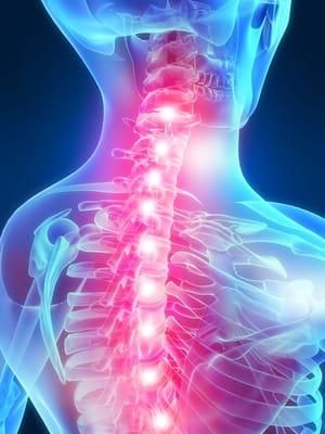 Conservative treatment such as spinal manipulation should be pursued in most cases before considering surgical intervention