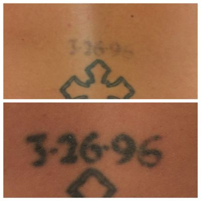 After 4 tattoo removal treatments