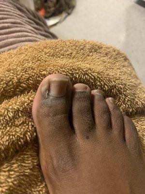 My infected toe! Please DO NOT waste your money and energy on these people!