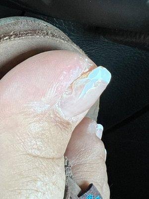 Acrylic nail