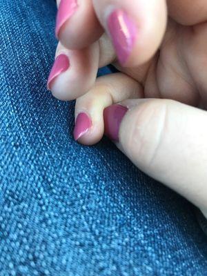 Cut under pinky nail.