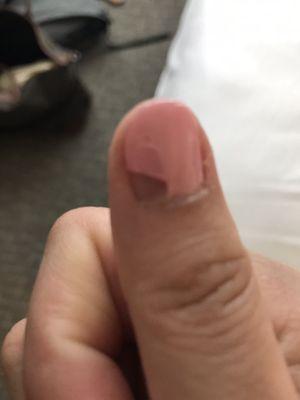 Thumb chipped 2 days later