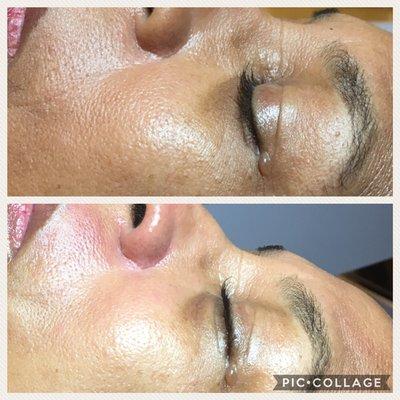 Refined Dermaplaning Facial