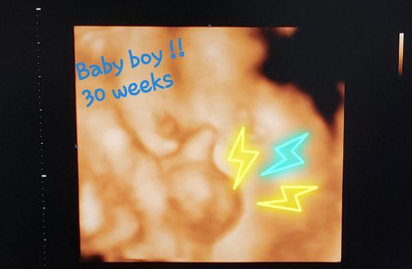 Oh baby boy!
37 weeks
3d Ultrasound Image