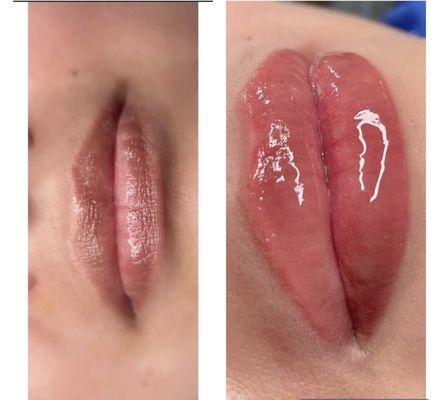 Lip Blush. A cosmetic tattoo of the lips. Results lasts up to 2-3 years depending on lifestyle and aftercare.