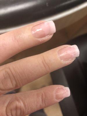 Nails showing gel ground off