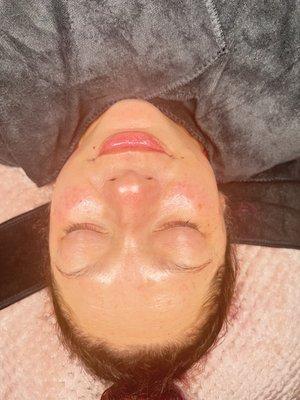 after dermaplaning add on to harmony facial