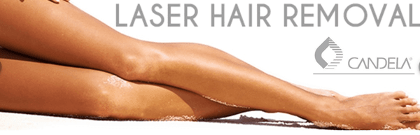 laser hair removal