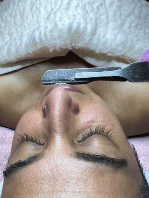 Removing dead skin off the nose with our Dermaplane treatment.