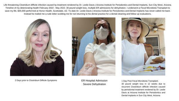 This is a timeline of my deteriorating health from a Clostridium difficile infection following a procedure performed by Dr Leslie Davis