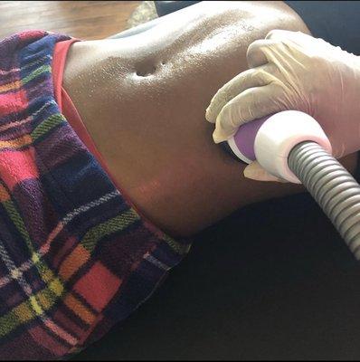 Ultrasonic Cavitation!!!!